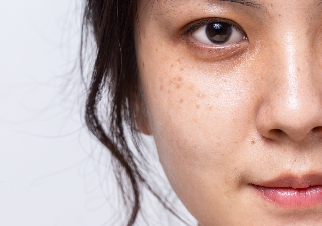 インモードのイメージ写真